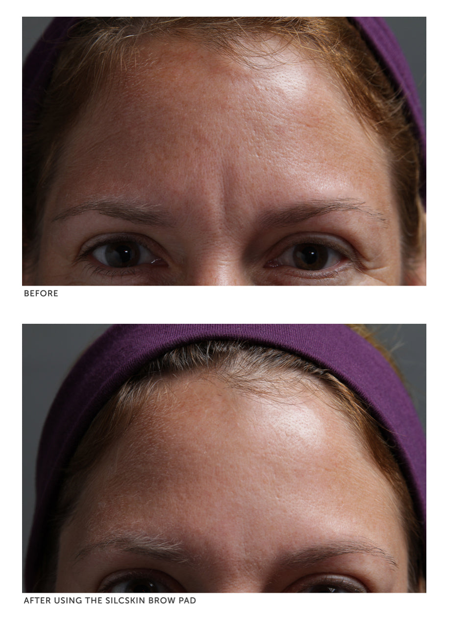 SilcSkin Brow Pads