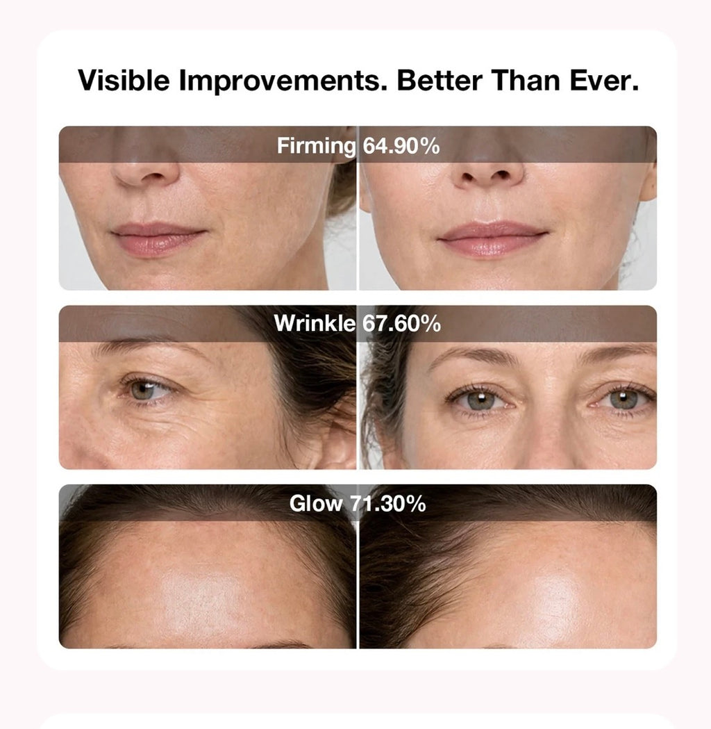 6D Laser & EMS Anti-Aging Therapy Mask