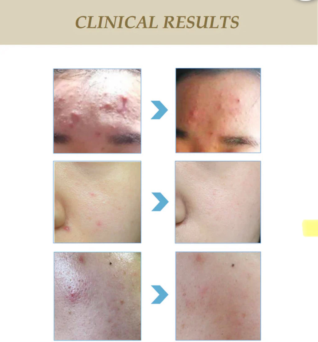 ToniSure Plasma & Galvanic