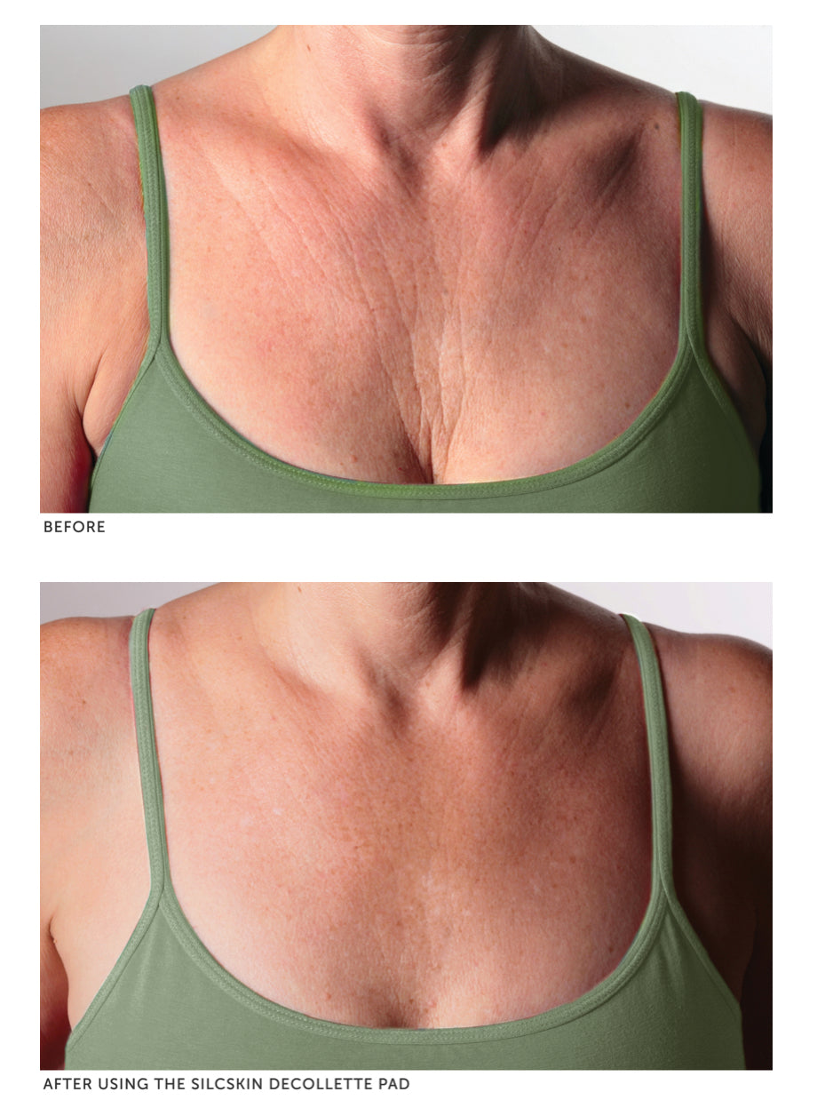 SilcSkin Decollette Pads