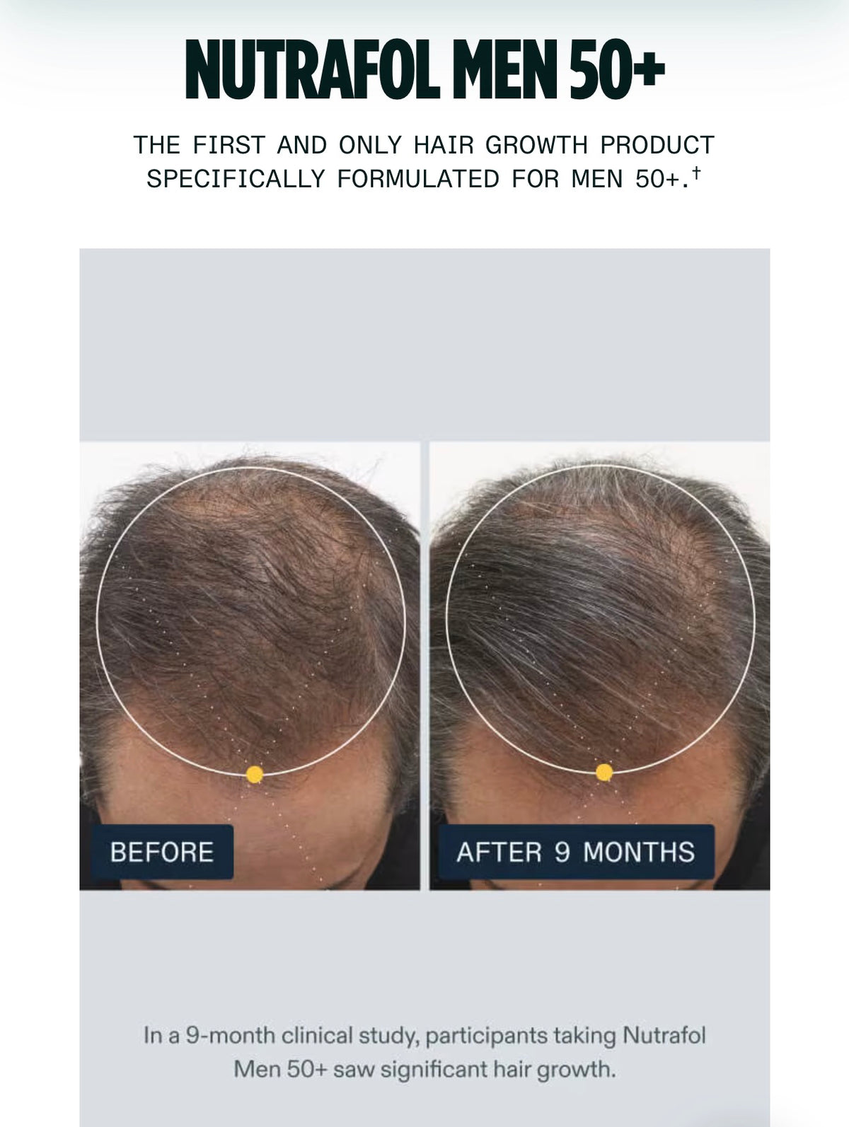 Nutrafol Men 50+