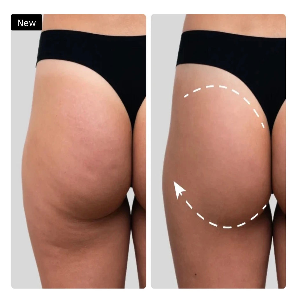 EMS Toning Shorts