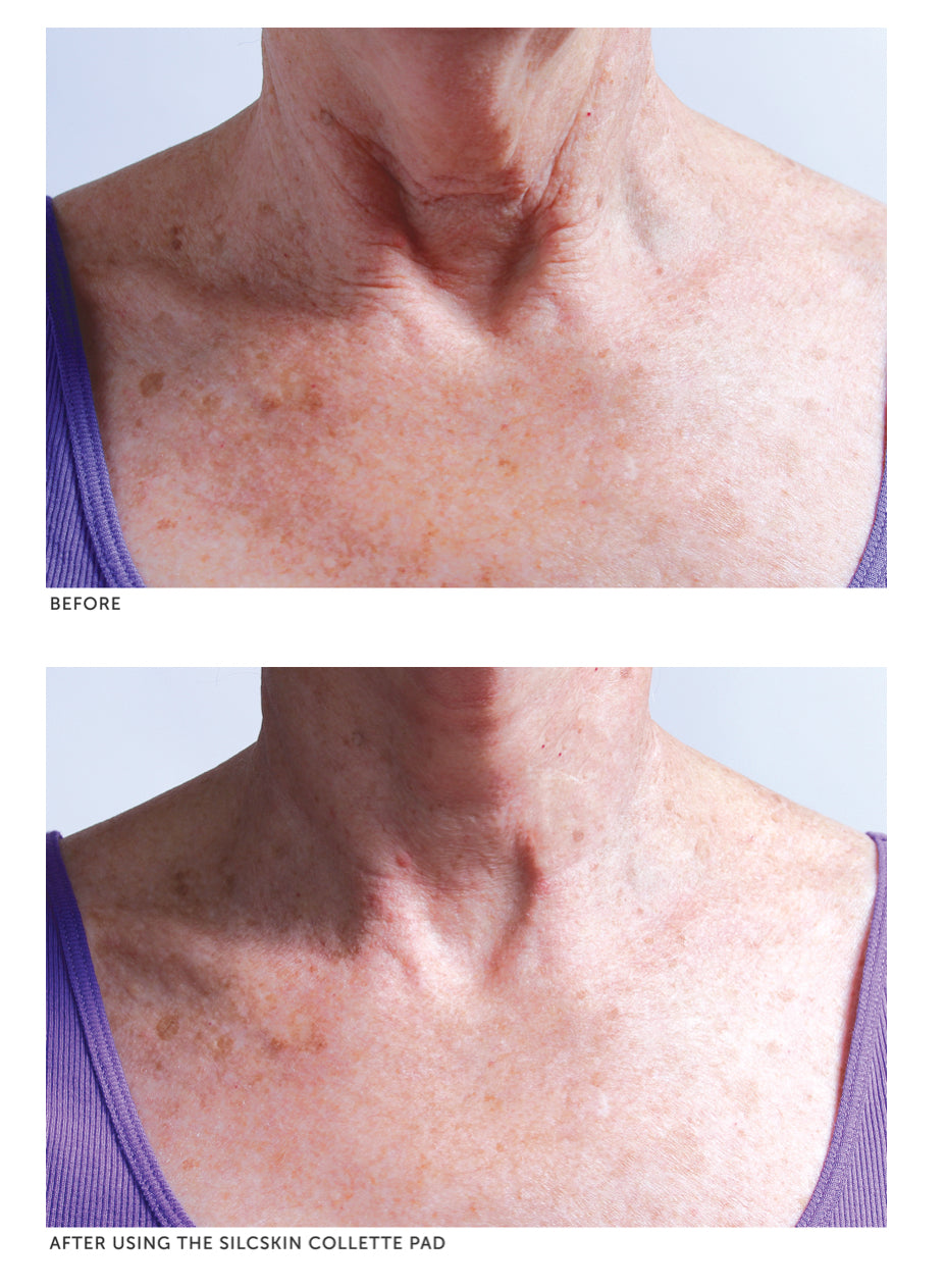 SilcSkin Collette Pad