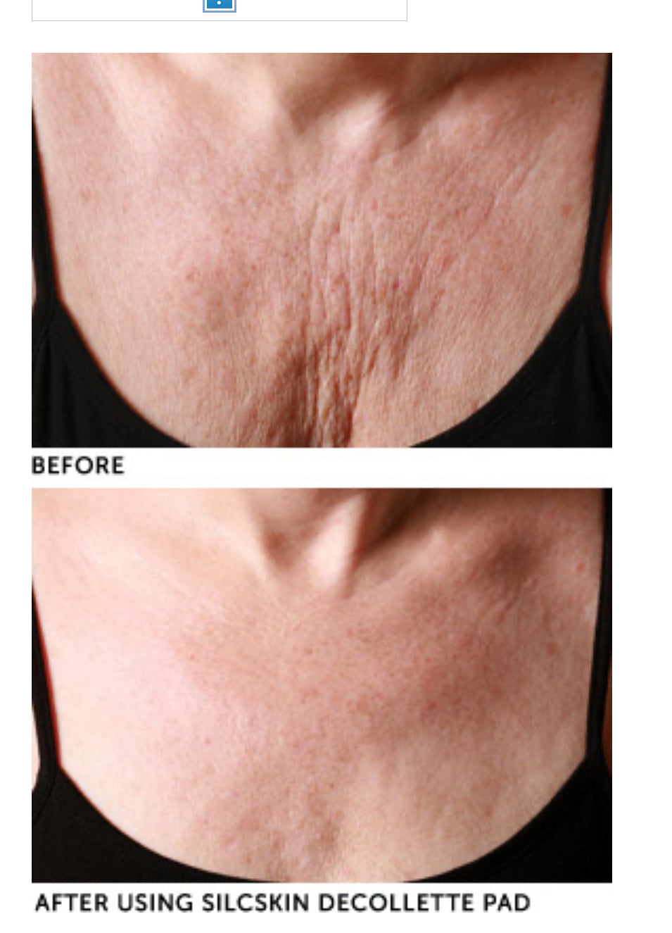 SilcSkin Decollette Pads