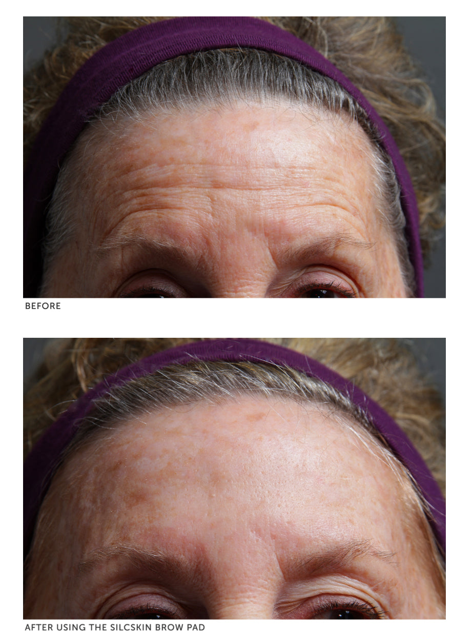 SilcSkin Brow Pads