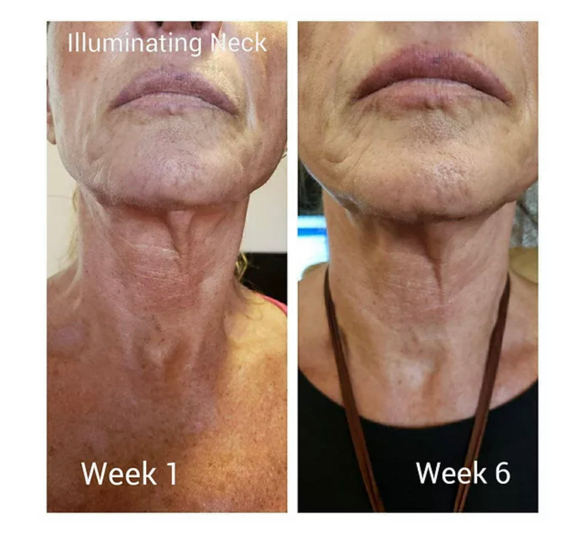 Illuminating Neck