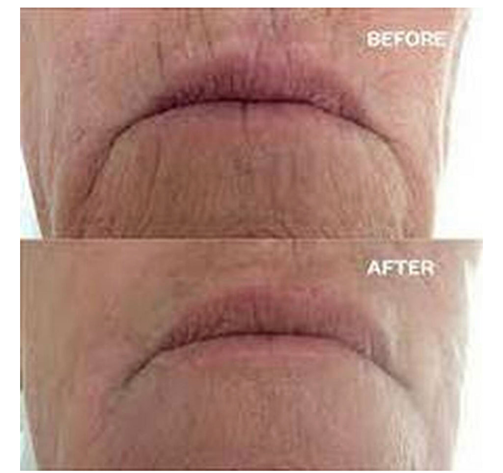 Dream Box Silicone Mask Pads