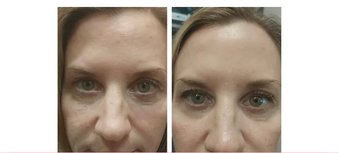 Illuminating Eye
