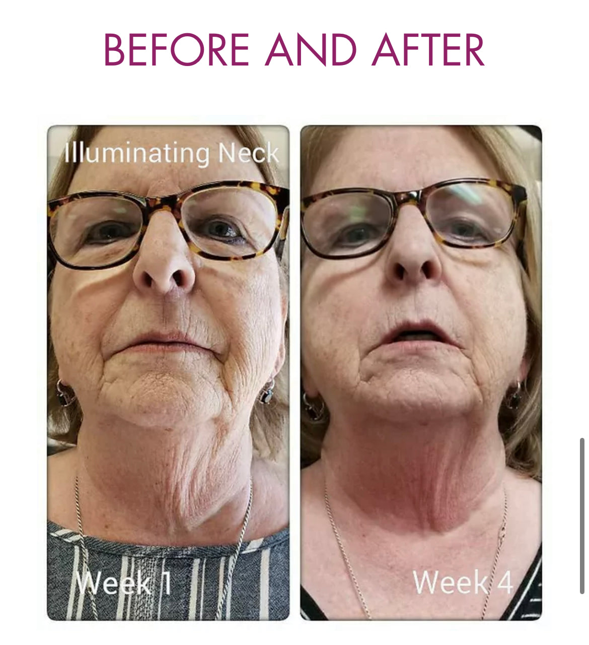 Illuminating Neck